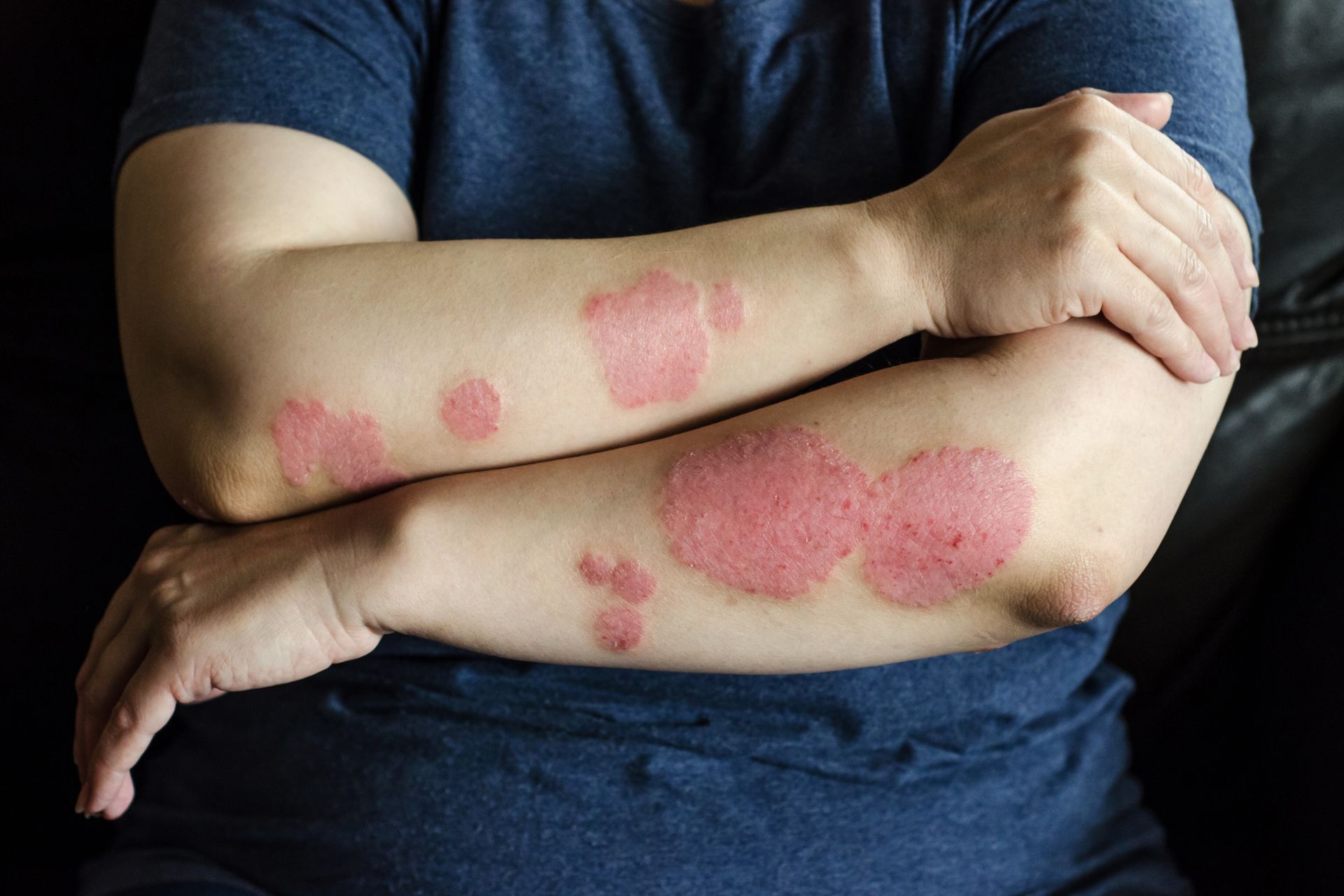 Common Skin Disorders & Diseases